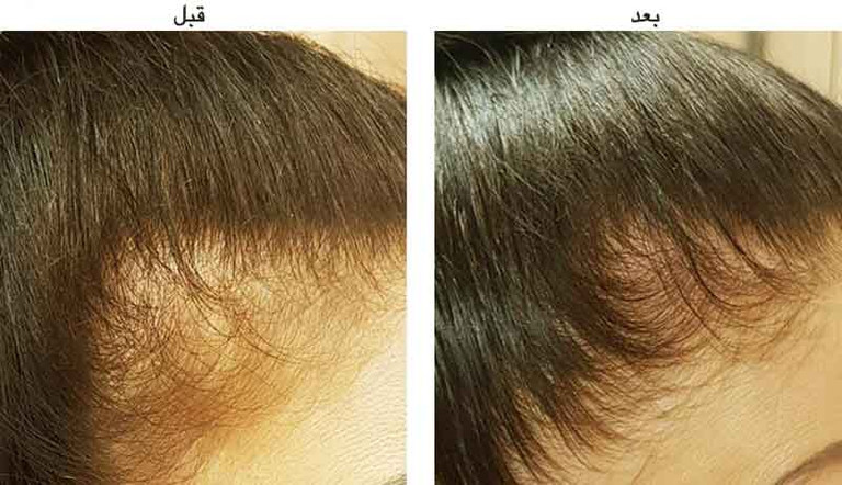 آمیلا رباسین